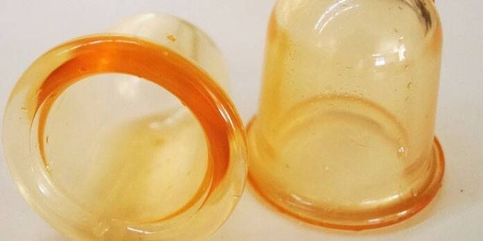 csészék a prosztatagyulladás kezelésére